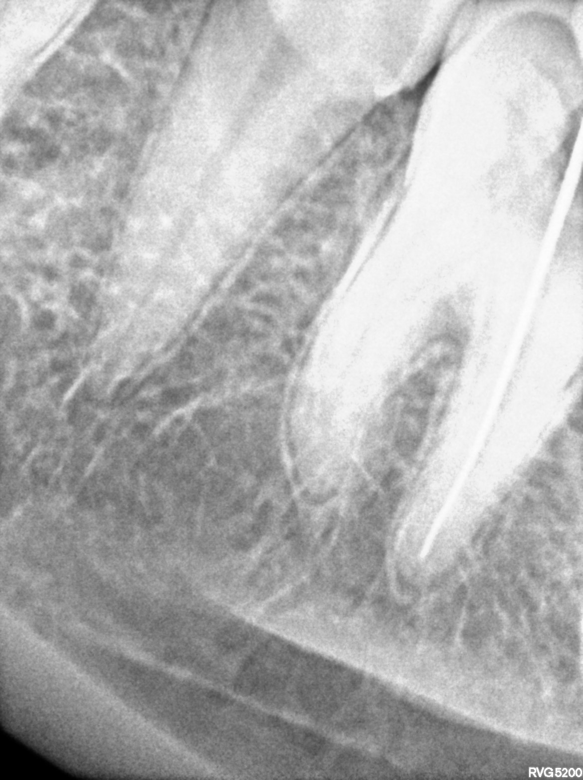 Dental X-ray
